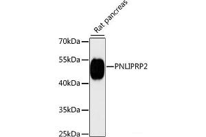 Western blot analysis of extracts of Rat pancreas using PNLIPRP2 Polyclonal Antibody at dilution of 1:3000. (PNLIPRP2 anticorps)