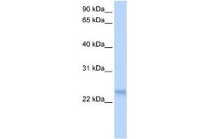 WB Suggested Anti-SFRS3 Antibody Titration: 0. (SRSF3 anticorps  (N-Term))