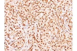 IHC-P Image Immunohistochemical analysis of paraffin-embedded A549 xenograft, using RG9MTD3, antibody at 1:500 dilution.