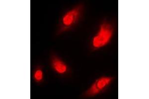 Immunofluorescent analysis of NAA15 staining in THP1 cells. (NAA15 anticorps  (Center))