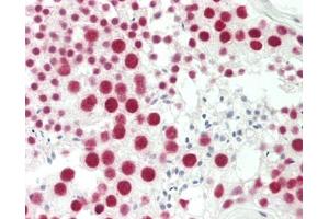 Human Testis: Formalin-Fixed, Paraffin-Embedded (FFPE)