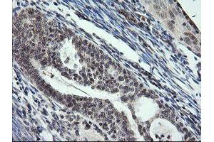 anti-Kinesin Family Member 25 (KIF25) antibody