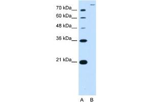 WB Suggested Antibody Titration:  2.