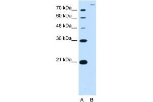 WB Suggested Antibody Titration:  2. (SLC26A5 anticorps  (Middle Region))