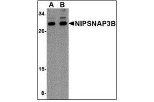 Western blot analysis of NIPSNAP3B in mouse brain tissue lysate with NIPSNAP3B antibody at (A) 1 and (B) 2 µg/ml (NIPSNAP3B anticorps  (Center))