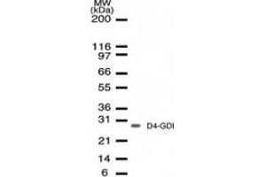 Image no. 1 for anti-rho GDP Dissociation Inhibitor (GDI) beta (ARHGDIB) (AA 125-137) antibody (ABIN207933) (ARHGDIB anticorps  (AA 125-137))
