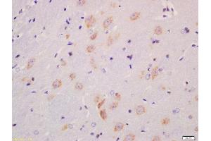 Formalin-fixed and paraffin embedded rat brain labeled with Anti-MST4 + MST3 + STK25 (Thr178 + Thr190 + Thr174) Polyclonal Antibody, Unconjugated  at 1:200 followed by conjugation to the secondary antibody and DAB staining (Mst4 / Mst3 / STK25 (pThr174), (pThr178), (pThr190) anticorps)