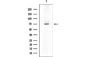 Western blot analysis of lysates from Mouse lung, using PKC alpha Mouse Monoclonal Antibody at 1/1000 dilution.