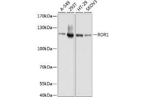 Western blot analysis of extracts of various cell lines, using ROR1 antibody (ABIN1682562, ABIN3017682, ABIN3017683 and ABIN6220210) at 1:1000 dilution. (ROR1 anticorps  (AA 30-200))