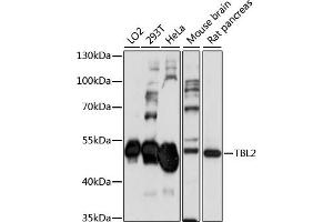 Western blot analysis of extracts of various cell lines, using TBL2 antibody (ABIN7270902) at 1:1000 dilution. (TBL2 anticorps  (AA 100-430))