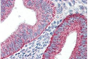 Human Uterus (formalin-fixed, paraffin-embedded) stained with HAVCR1 antibody ABIN337189 at 5 ug/ml followed by biotinylated goat anti-rabbit IgG secondary antibody ABIN481713, alkaline phosphatase-streptavidin and chromogen. (HAVCR1 anticorps  (Internal Region))