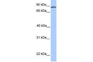 WB Suggested Anti-DMTF1 Antibody Titration:  0. (DMP1 anticorps  (C-Term))