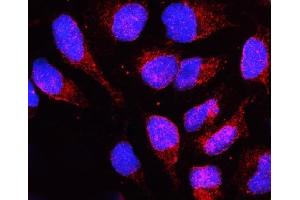 IF analysis of LBR using anti-LBR antibody (ABIN6719340). (Lamin B Receptor anticorps  (AA 102-209))