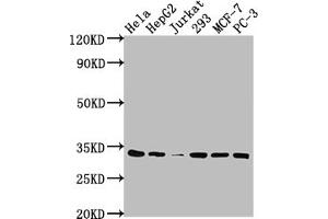 Western Blot Positive WB detected in: Hela whole cell lysate, HepG2 whole cell lysate, Jurkat whole cell lysate, 293 whole cell lysate, MCF-7 whole cell lysate, PC-3 whole cell lysate All lanes: CDK4 antibody at 1:2000 Secondary Goat polyclonal to rabbit IgG at 1/50000 dilution Predicted band size: 34, 21 kDa Observed band size: 34 kDa