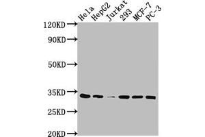 Western Blot Positive WB detected in: Hela whole cell lysate, HepG2 whole cell lysate, Jurkat whole cell lysate, 293 whole cell lysate, MCF-7 whole cell lysate, PC-3 whole cell lysate All lanes: CDK4 antibody at 1:2000 Secondary Goat polyclonal to rabbit IgG at 1/50000 dilution Predicted band size: 34, 21 kDa Observed band size: 34 kDa (Recombinant CDK4 anticorps)