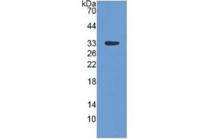 WB of Protein Standard: different control antibodies against Highly purified E.