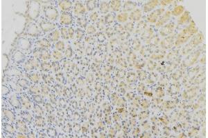 ABIN6273618 at 1/100 staining Human gastric tissue by IHC-P. (CYB5B anticorps  (Internal Region))