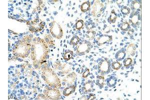 Image no. 1 for anti-RNA Binding Motif Protein 46 (RBM46) (AA 121-170) antibody (ABIN6736259)