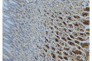 ABIN6277302 at 1/100 staining Human gastric tissue by IHC-P.