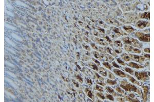 ABIN6277302 at 1/100 staining Human gastric tissue by IHC-P. (SDHA anticorps  (Internal Region))