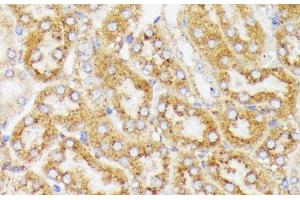 Immunohistochemistry of paraffin-embedded Mouse kidney using GALC Polyclonal Antibody at dilution of 1:100 (40x lens).