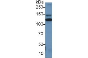Detection of ITIH4 in Rat Serum using Polyclonal Antibody to Inter Alpha-Globulin Inhibitor H4 (ITIH4)