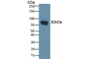 Western blot analysis of recombinant Rat CA2. (CA2 anticorps)