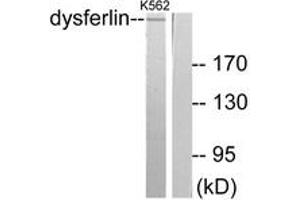Western blot analysis of extracts from K562 cells, using Dysferlin Antibody. (Dysferlin anticorps  (AA 1981-2030))