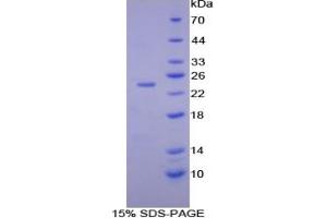 Mouse Detection antibody from the kit in WB with Positive Control: Human lymphocyte lysates.