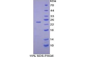 Mouse Detection antibody from the kit in WB with Positive Control: Human lymphocyte lysates. (IL-10 Kit ELISA)
