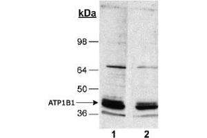 Detection of ATP1B1 in rat kidney homogenates (20 ug) using ATP1B1 monoclonal antibody, clone 464. (ATP1B1 anticorps)