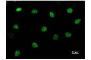 Immunostaining analysis in HeLa cells. (CHD1L anticorps)