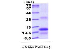 SDS-PAGE (SDS) image for Thyroid Stimulating Hormone, beta (TSHB) (AA 21-138) protein (His tag) (ABIN6387330) (TSHB Protein (AA 21-138) (His tag))
