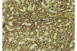ABIN6277119 at 1/100 staining Mouse kidney tissue by IHC-P. (p63 anticorps)