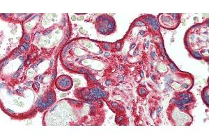 Immunohistochemistry of paraffin-embedded Placenta tissue using CLTC Polyclonal Antibody at dilution of 1:60.