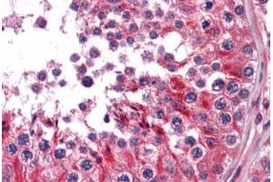 Human Testis: Formalin-Fixed, Paraffin-Embedded (FFPE) (RRAS2 anticorps  (AA 1-205))