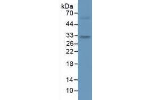 Rabbit Detection antibody from the kit in WB with Positive Control: Rat large intestine tissue.