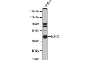 Western blot analysis of extracts of Rat liver cells, using DG antibody (ABIN6130268, ABIN6139559, ABIN6139561 and ABIN6218054) at 1:3000 dilution. (DGAT2 anticorps  (AA 113-388))