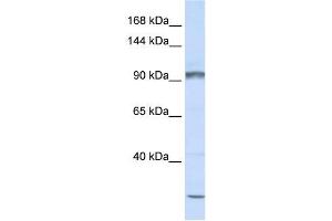 PCDHAC2 antibody used at 1 ug/ml to detect target protein. (PCDHAC2 anticorps  (N-Term))