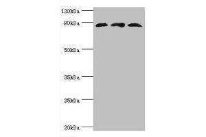 Western blot All lanes: Cullin-1 antibody at 6 μg/mL Lane 1: PC-3 whole cell lysate Lane 2: K562 whole cell lysate Lane 3: Hela whole cell lysate Secondary Goat polyclonal to rabbit IgG at 1/10000 dilution Predicted band size: 90 kDa Observed band size: 90 kDa (Cullin 1 anticorps  (AA 500-776))
