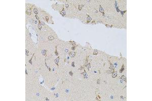 Immunohistochemistry of paraffin-embedded rat brain using NAPA antibody. (NAPA anticorps)