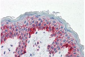 Human Skin (formalin-fixed, paraffin-embedded) stained with B2M antibody ABIN334257 at 5 ug/ml followed by biotinylated anti-mouse IgG secondary antibody ABIN481714, alkaline phosphatase-streptavidin and chromogen. (beta-2 Microglobulin anticorps)