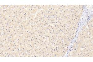 Detection of DNASEII in Human Liver Tissue using Polyclonal Antibody to Deoxyribonuclease II (DNASEII)