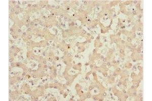 Immunohistochemistry of paraffin-embedded human liver tissue using ABIN7165661 at dilution of 1:100 (IWS1 anticorps  (AA 570-819))