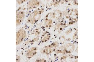 Immunohistochemistry of paraffin-embedded human stomach tissue using KPNA4 antibody at dilution of 1:200 (x400 lens).