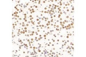 Immunohistochemistry of paraffin embedded mouse neonatal mouse',s brain using LDOCL (ABIN7075411) at dilution of 1:1400 (400x lens) (Retrotransposon Gag-Like Protein 6 (RTL6) anticorps)