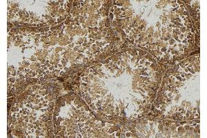 ABIN6277160 at 1/100 staining Mouse testis tissue by IHC-P. (Moesin anticorps  (C-Term))