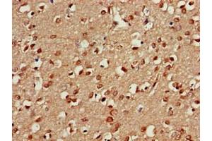 Immunohistochemistry of paraffin-embedded human brain tissue using ABIN7164960 at dilution of 1:100 (PSMA5 anticorps  (AA 124-180))