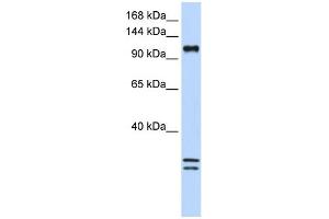 WB Suggested Anti-NCKAP1L Antibody Titration:  0. (NCKAP1L anticorps  (C-Term))