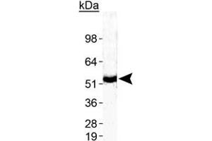 Western blot analysis of ZMPSTE24 in human testis with ZMPSTE24 polyclonal antibody . (ZMPSTE24 anticorps  (AA 400-475))